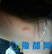 17qкŮǺۆ װl(f)ʲô